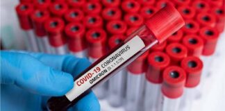 Pandemia: FENAMP e ANSEMP pedem adoção de trabalho remoto no MP-AM